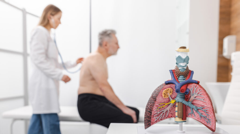 Dépistage cancer du poumon
